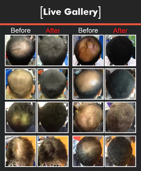 Dexe Hair Building Fibers (Imported)